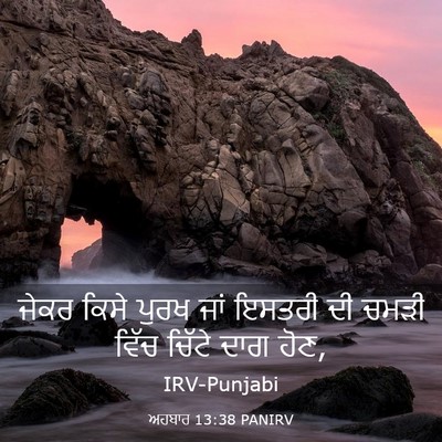 Picture 03 - ਅਹਬਾਰ 13:38 PANIRV - ਜੇਕਰ ਕਿਸੇ ਪੁਰਖ ਜਾਂ - Bible Verse Picture