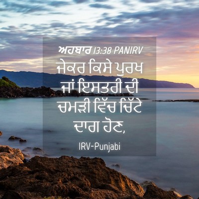 Picture 04 - ਅਹਬਾਰ 13:38 PANIRV - ਜੇਕਰ ਕਿਸੇ ਪੁਰਖ ਜਾਂ - Bible Verse Picture