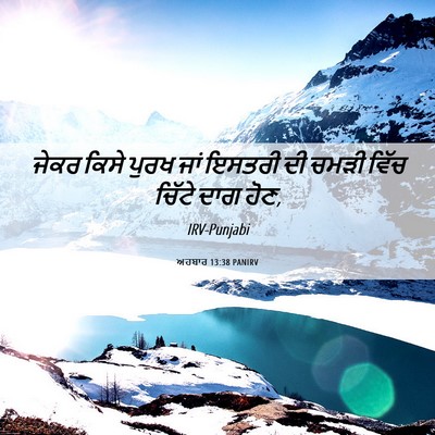 Picture 06 - ਅਹਬਾਰ 13:38 PANIRV - ਜੇਕਰ ਕਿਸੇ ਪੁਰਖ ਜਾਂ - Bible Verse Picture